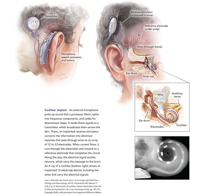 Illustration of ear
